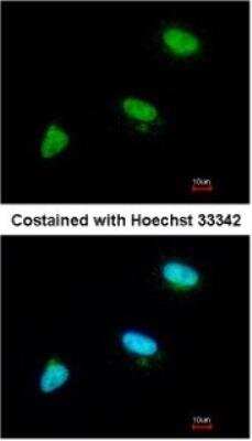 Immunocytochemistry/Immunofluorescence: UbcH3/Cdc34 Antibody [NBP1-32153] - Paraformaldehyde-fixed A549, using antibody at 1:200 dilution.