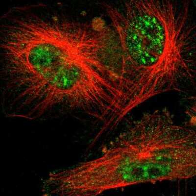 Immunocytochemistry/Immunofluorescence: UbcH3/Cdc34 Antibody [NBP1-84946] - Immunofluorescent staining of human cell line U-251 MG shows localization to nuclear speckles & cytosol.