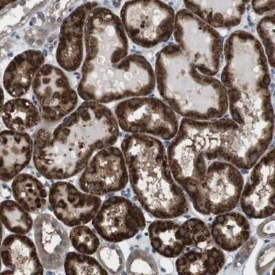 Immunohistochemistry-Paraffin: UbcH3/Cdc34 Antibody [NBP1-84946] - Staining of human kidney shows strong cytoplasmic positivity in cells of tubules.