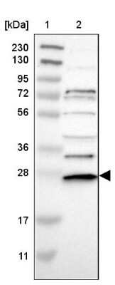 Western Blot UBE2R1/CDC34 Antibody - BSA Free