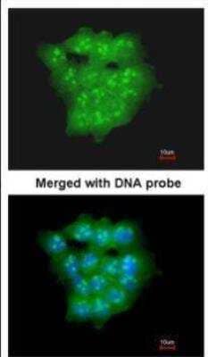 Immunocytochemistry/Immunofluorescence: UbcH5a/UBE2D1 Antibody [NBP1-32734] - Analysis of paraformaldehyde-fixed A431, using UBE2D1 antibody at 1:200 dilution.