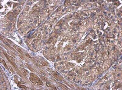 Immunohistochemistry-Paraffin: UbcH5a/UBE2D1 Antibody [NBP1-32734] - Mouse prostate. UBE2D1 antibody dilution: 1:500. Antigen Retrieval: Trilogy™ (EDTA based, pH 8.0) buffer, 15min. 