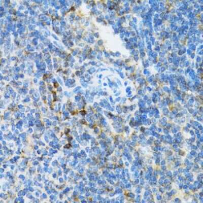 Immunohistochemistry-Paraffin: UbcH5a/UBE2D1 Antibody [NBP2-93678] - Paraffin-embedded mouse spleen using UbcH5a/UBE2D1 .