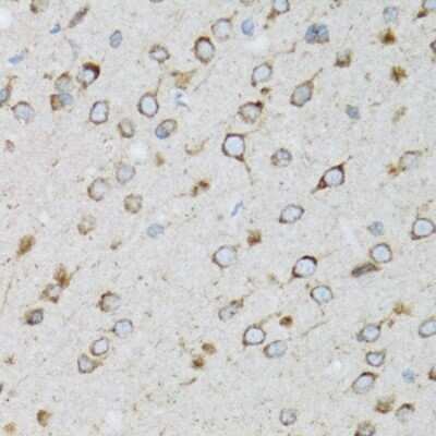 Immunohistochemistry-Paraffin: UbcH5a/UBE2D1 Antibody [NBP2-93678] - Paraffin-embedded rat brain using UbcH5a/UBE2D1 .