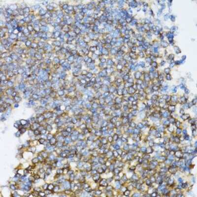 Immunohistochemistry-Paraffin: UbcH5a/UBE2D1 Antibody [NBP2-93678] - Paraffin-embedded rat spleen using UbcH5a/UBE2D1 .