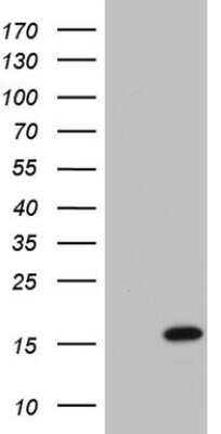 Western Blot: UbcH5a/UBE2D1 Antibody (OTI1E7) - Azide and BSA Free [NBP2-74731] - Analysis of HEK293T cells were transfected with the pCMV6-ENTRY control (Left lane) or pCMV6-ENTRY UBE2D1 .