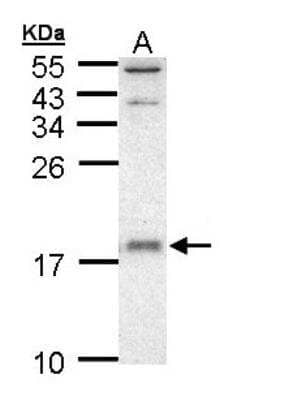 Western Blot UbcH5a/UBE2D1 Antibody