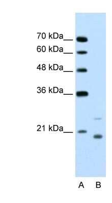 Western Blot: UbcH5a/UBE2D1 Antibody [NBP1-55033] - Jurkat cell lysate, concentration 1.25ug/ml.