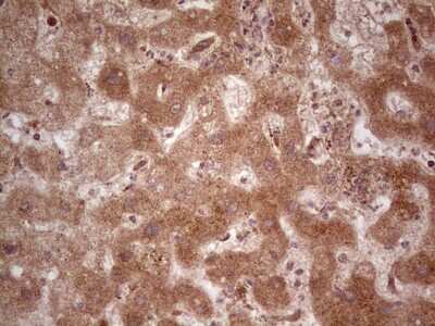 Immunohistochemistry: UbcH5b/UBE2D2 Antibody (2C2) [NBP2-46270] - Analysis of Human liver tissue. (Heat-induced epitope retrieval by 1 mM EDTA in 10mM Tris, pH8.5, 120C for 3min)