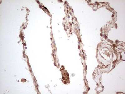 Immunohistochemistry: UbcH5b/UBE2D2 Antibody (2C2) [NBP2-46270] - Analysis of Human lung tissue. (Heat-induced epitope retrieval by 1 mM EDTA in 10mM Tris, pH8.5, 120C for 3min)