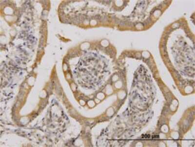 Immunohistochemistry-Paraffin: UbcH5b/UBE2D2 Antibody (4A1) [H00007322-M02] - Analysis of monoclonal antibody to UBE2D2 on formalin-fixed paraffin-embedded human small Intestine. Antibody concentration 3 ug/ml.