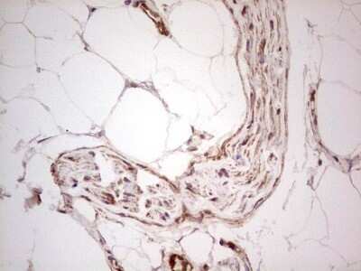 Immunohistochemistry: UbcH5b/UBE2D2 Antibody (OTI2C2) - Azide and BSA Free [NBP2-74732] - Analysis of Human bladder tissue. (Heat-induced epitope retrieval by 1 mM EDTA in 10mM Tris, pH8.5, 120C for 3min)