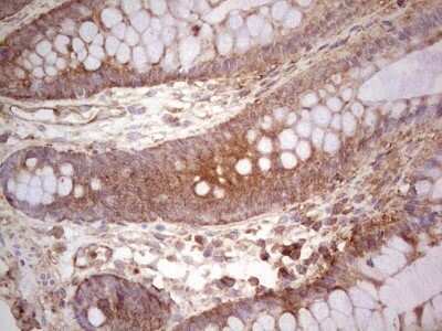 Immunohistochemistry: UbcH5b/UBE2D2 Antibody (OTI2C2) - Azide and BSA Free [NBP2-74732] - Analysis of Human colon tissue. (Heat-induced epitope retrieval by 1 mM EDTA in 10mM Tris, pH8.5, 120C for 3min)