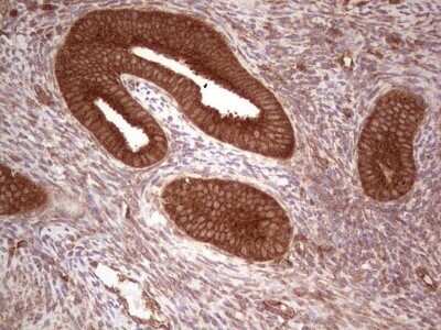 Immunohistochemistry: UbcH5b/UBE2D2 Antibody (OTI2C2) - Azide and BSA Free [NBP2-74732] - Analysis of Human endometrium tissue. (Heat-induced epitope retrieval by 1 mM EDTA in 10mM Tris, pH8.5, 120C for 3min)