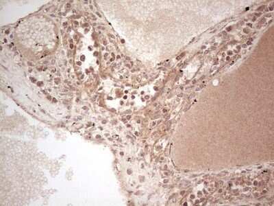 Immunohistochemistry: UbcH5b/UBE2D2 Antibody (OTI2C2) - Azide and BSA Free [NBP2-74732] - Analysis of Human lymph node tissue. (Heat-induced epitope retrieval by 1 mM EDTA in 10mM Tris, pH8.5, 120C for 3min)