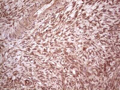 Immunohistochemistry: UbcH5b/UBE2D2 Antibody (OTI2C2) - Azide and BSA Free [NBP2-74732] - Analysis of Human Ovary tissue. (Heat-induced epitope retrieval by 1 mM EDTA in 10mM Tris, pH8.5, 120C for 3min)