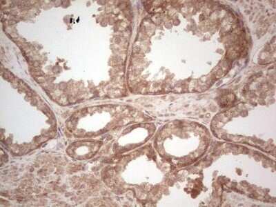 Immunohistochemistry: UbcH5b/UBE2D2 Antibody (OTI2C2) - Azide and BSA Free [NBP2-74732] - Analysis of Human prostate tissue. (Heat-induced epitope retrieval by 1 mM EDTA in 10mM Tris, pH8.5, 120C for 3min)