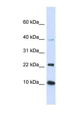 Western Blot: UbcH5b/UBE2D2 Antibody [NBP1-55275] - Human Brain lysate, concentration 0.2-1 ug/ml.