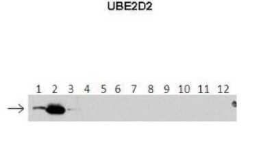 Western Blot: UbcH5b/UBE2D2 Antibody [NBP1-55275] - Lanes: 1 : 40 ng HIS-UBE2D1 protein2: 40 ng HIS-UBE2D2 protein3: 40 ng HIS-UBE2D3 protein4: 40 ng HIS-UBE2D4 protein5: 40 ng HIS-UBE2E1 protein6: 40 ng HIS-UBE2E2 protein7: 40 ng HIS-UBE2E3 protein8: 40 ng HIS-UBE2K protein9: 40 ng HIS-UBE2L3 protein10: 40 ng HIS-UBE2N protein11 : 40 ng HIS-UBE2V1 protein12: 40 ng HIS-UBE2V2 protein. Primary Antibody Dilution: 1 : 500 Secondary Antibody: Anti-rabbit-HRP Secondary Antibody Dilution: 1 : 50,000 Gene name: UBE2D2 Submitted by: Dr Chris Boutell. MRC-UoG Centre for Virus Research (CVR), UK.