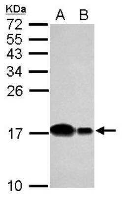 Western Blot: UbcH5b/UBE2D2 Antibody [NBP2-20783] -  Sample (30 ug of whole cell lysate) A: NT2D1 B: U87-MG 15% SDS PAGE gel, diluted at 1:1000.