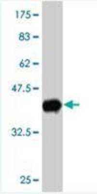 Western Blot: UbcH5c/UBE2D3 Antibody (4C1-1E3) [H00007323-M01] - Antibody Reactive Against Recombinant Protein. Western Blot detection against Immunogen (42.28 KDa) .