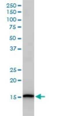 Western Blot: UbcH5c/UBE2D3 Antibody (4C1-1E3) [H00007323-M01] - UBE2D3 monoclonal antibody (M01), clone 4C1-1E3 Analysis of UBE2D3 expression in Jurkat.