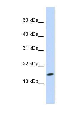 Western Blot: UbcH5c/UBE2D3 Antibody [NBP1-55276] - MCF-7 whole cell lysates, concentration 0.2-1 ug/ml.