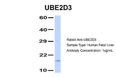 Western Blot: UbcH5c/UBE2D3 Antibody [NBP1-55276] - Human Fetal Liver, Antibody Dilution: 1.0 ug/ml.