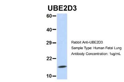 Western Blot: UbcH5c/UBE2D3 Antibody [NBP1-55276] - Human Fetal Lung, Antibody Dilution: 1.0 ug/ml.