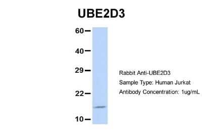 Western Blot: UbcH5c/UBE2D3 Antibody [NBP1-55276] - Jurkat, Antibody Dilution: 1.0 ug/ml UBE2D3 is strongly supported by BioGPS gene expression data to be expressed in Jurkat.