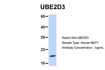 Western Blot: UbcH5c/UBE2D3 Antibody [NBP1-55276] - MCF7, Antibody Dilution: 1.0 ug/ml UBE2D3 is strongly supported by BioGPS gene expression data to be expressed in MCF7.