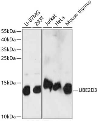 Western Blot: UbcH5c/UBE2D3 Antibody [NBP2-93898] - Analysis of extracts of various cell lines, using UbcH5c/UBE2D3 at 1:1000 dilution. Secondary antibody: HRP Goat Anti-Rabbit IgG (H+L) at 1:10000 dilution. Lysates/proteins: 25ug per lane. Blocking buffer: 3% nonfat dry milk in TBST. Detection: ECL Basic Kit . Exposure time: 15s.