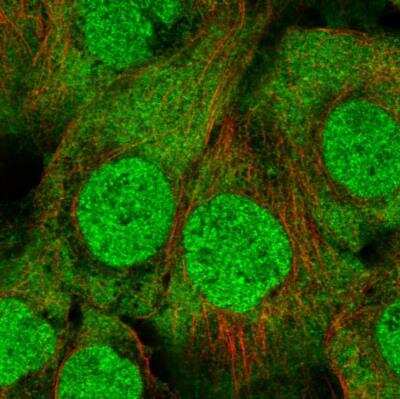 Immunocytochemistry/Immunofluorescence: UbcH7/UBE2L3 Antibody [NBP2-49367] - Staining of human cell line A-431 shows localization to nucleus & cytosol. Antibody staining is shown in green.