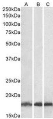 Western Blot: UbcH7/UBE2L3 Antibody [NB300-841] - Analysis of Human (A), Mouse (B) and Rat (C) Skeletal Muscle lysates (35ug protein in RIPA buffer).