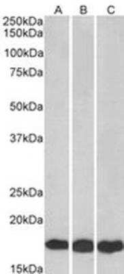 Western Blot: UbcH7/UBE2L3 Antibody [NB300-841] - Analysis of HEK293 (A), HepG2 (B) and Jurkat (C) lysates (35ug protein in RIPA buffer).