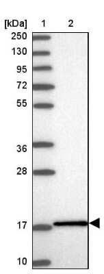 Western Blot: UbcH7/UBE2L3 Antibody [NBP1-92557] - Lane 1: Marker [kDa] 250, 130, 95, 72, 55, 36, 28, 17, 10Lane 2: Human cell line RT-4