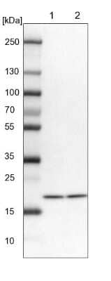 Western Blot: UbcH7/UBE2L3 Antibody [NBP1-92557] - Lane 1: NIH-3T3 cell lysate (Mouse embryonic fibroblast cells) Lane 2: NBT-II cell lysate (Rat Wistar bladder tumour cells)