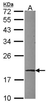 Western Blot: Ube2G1 Antibody [NBP2-20785] - Sample (30 ug of whole cell lysate) A: HCT116 12% SDS PAGE gel, diluted at 1:1000.