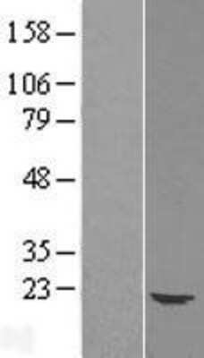 Western Blot: Ube2G1 Overexpression Lysate (Adult Normal) [NBL1-17528] Left-Empty vector transfected control cell lysate (HEK293 cell lysate); Right -Over-expression Lysate for Ube2G1.