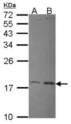 Western Blot: Ube2L3 Antibody [NBP2-20786] - Sample (30 ug of whole cell lysate) A: JurKat B: Hela 12% SDS PAGE gel, diluted at 1:1000.