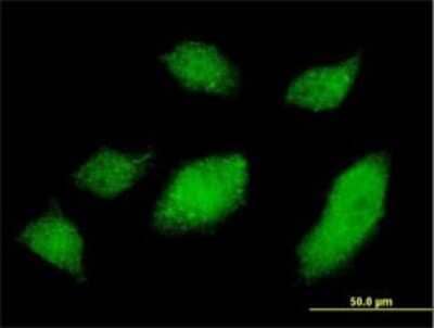 Immunocytochemistry/Immunofluorescence: Ubiquilin 1 Antibody (1C6-A3) [H00029979-M01] - Analysis of monoclonal antibody to UBQLN1 on HeLa cell . Antibody concentration 10 ug/ml.