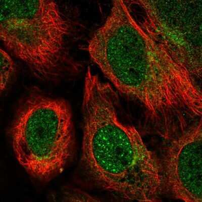 Immunocytochemistry/Immunofluorescence: Ubiquilin 1 Antibody [NBP2-58403] - Staining of human cell line U-2 OS shows localization to nucleoplasm & cytosol.