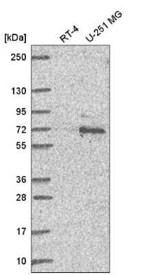 Western Blot: Ubiquilin 1 Antibody [NBP2-58403] - Western blot analysis in human cell line RT-4 and human cell line U-251 MG.