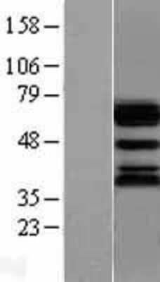 Western Blot Ubiquilin 1 Overexpression Lysate