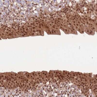 Immunohistochemistry-Paraffin: Ubiquitin Antibody [NBP2-54736] - Staining of human urinary bladder shows nuclear and cytoplasmic positivity in urothelial cells.