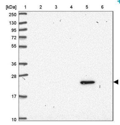 Western Blot: Ubiquitin Antibody [NBP2-54736] - Lane 1: Marker [kDa] 250, 130, 95, 72, 55, 36, 28, 17, 10Lane 2: Human cell line RT-4 Lane 3: Human cell line U-251 MG Lane 4: Human plasma Lane 5: Human Liver tissue Lane 6: Human Tonsil tissue