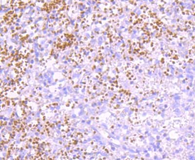 Immunohistochemistry-Paraffin: Ubiquitin B Antibody (JM09-67) [NBP2-66759] - Analysis of paraffin-embedded human spleen tissue using anti-K63-linkage Specific Ubiquitin antibody. Counter stained with hematoxylin.