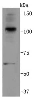 Western Blot: Ubiquitin B Antibody (JM09-67) [NBP2-66759] - Analysis of K63-linkage Specific Ubiquitin on Hela cells lysates using anti-K63-linkage Specific Ubiquitin antibody at 1/1,000 dilution.