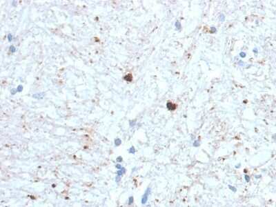 Immunohistochemistry-Paraffin: Ubiquitin B Antibody (UBB/1748) [NBP3-08905] - Formalin-fixed, paraffin-embedded human Brain stained with Ubiquitin B-Monospecific Mouse Monoclonal Antibody (UBB/1748).