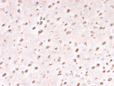 Immunohistochemistry-Paraffin: Ubiquitin B Antibody (UBB/1748) [NBP3-08905] - Formalin-fixed, paraffin-embedded human Brain stained with Ubiquitin B-Monospecific Mouse Monoclonal Antibody (UBB/1748).